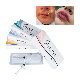 Singfiller Manufaturer Cross-Linked Hyaluronic Acid Dermal Filler for Plastic Surgery