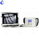  High Frequency Dental X Ray Machine Portable Dental X-ray Unit