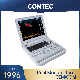  Contec Cms1700b Portable Scanner Color Doppler Ultrasound