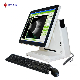 CAS-2000d China Ophthalmic Equipment Ophthalmology Ultrasound Ab Scanner a B Scan with Built-in Computer