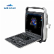 Professional 4D Color Doppler Sonoscape Ultrasound Scanner/Portable Sonoscape S8 Exp