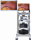 Medical 1080P Intelligent Digital Full HD Ent Endoscopy Machine Endoscope Camera with All Accessories
