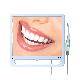 Portable 17 Inches Dental Intraoral Camera Wireless with Monitor Display