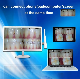 Big Touch Screen for Dental Camera Intra Oral Camera